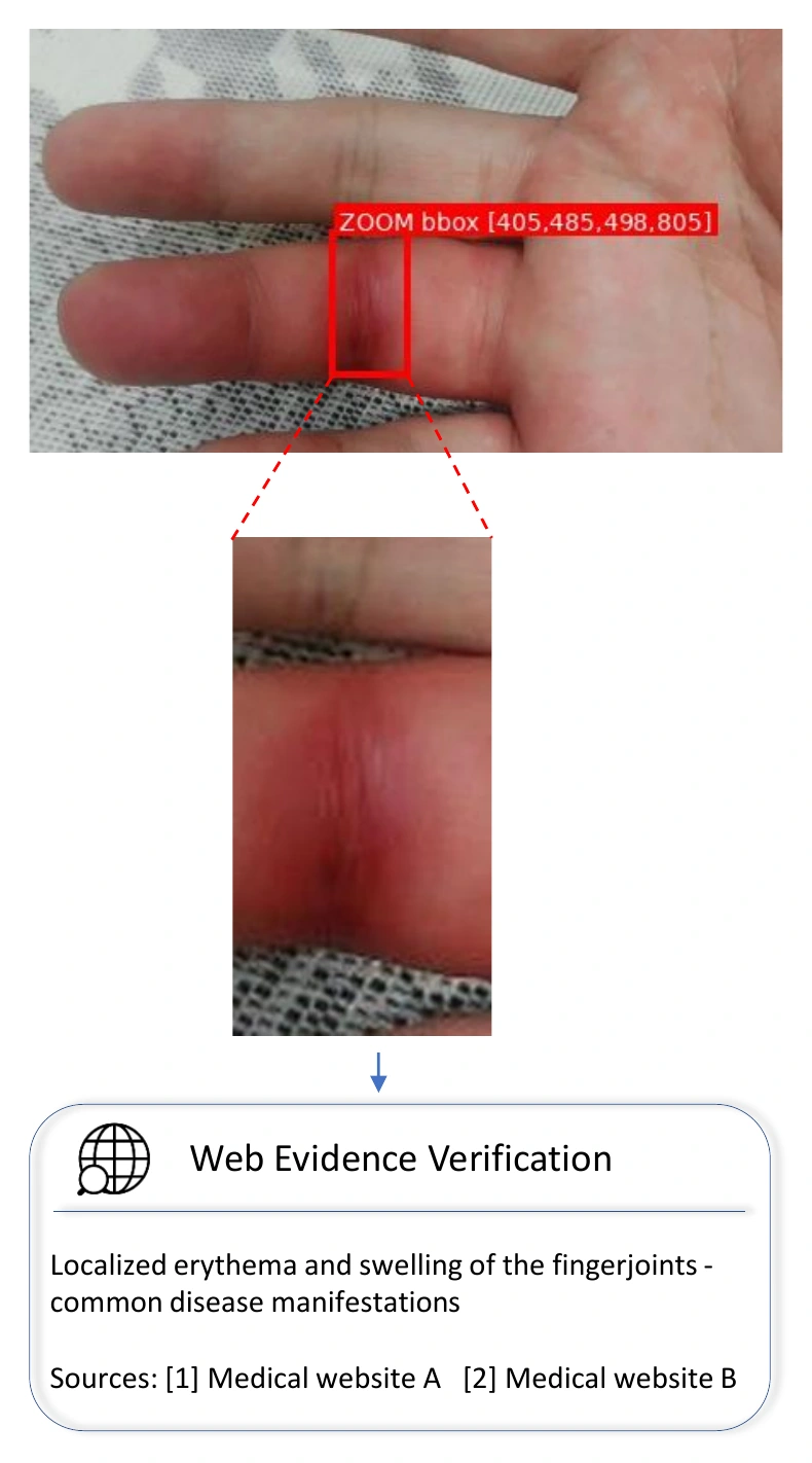 Case 1 using zoom and external search to assess swelling around a finger joint